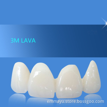 Porcelain Teeth 3m lava